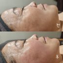 범어역 4번 출구 앞 | 대구 수성구잔주름 범어동미레브 멋진인생에스테틱 범어점