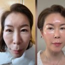 글로벌뷰티점인셀덤 | 인셀덤 화장품이 핫한 이유? 직접 써본 사람들이 계속 찾는 이유