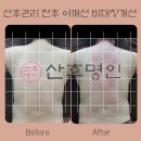 산후명인인천