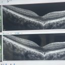 우안과의원 이미지