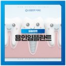 선플란트치과의원 | 용인임플란트 치료 전 불안함까지함께 고려하는 진료 시스템