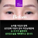 비씨아이성형외과의원 이미지