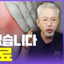 자가 줄기세포 주사 치료 : 내몸이 나를 살린다! 기존 무릎 주사치료의 한계와 자가줄기세포 주사의 비밀 이미지