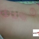 바른맥한의원 이미지