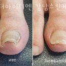 닥터아이티엔강남스킨케어 네이버블로그
