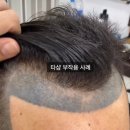 지성헤어라인