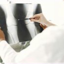 운동처방재활 이미지