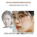 예담한약국 | ★찐 피부관리는 한번 만으로도 속광이 올라옵니다★
