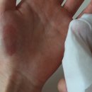 피그만클리닉 이미지