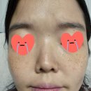 아마란스 어린이집 | 메이크나인 기미관리 3종제품으로 미백효과와 수분감 챙기세요!