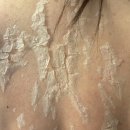 필약국 | 내돈내산 등 알라딘필링 후기 [의정부 루비나 피부&amp;바디]