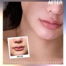 청담여신성형외과의원 이미지