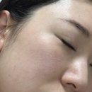 차오름 정보기술 | 튠페이스+동안차오름 스킨부스터로 중안부 축소 효과 보기
