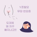 비원가발