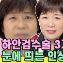 하안검수술 3개월 후 ⭐️여배우⭐️처럼 우아~해진 인상, 많이 달라졌죠？ 이미지