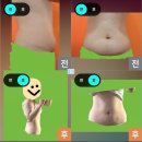 365엠씨(mc)병원 | 👙 [무한람스 리얼 후기] 복부 무한람스 — 5주차 찐 후기👙