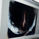 광정로 | 산본 두피케어 후기,모앤두피탈모 산본점에서 SMD케어 받고 온 솔직 후기 어무니 생신선물 추천!