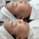 라미르스킨룸 | 광주 여드름 관리 맛집 중흥동 라미르