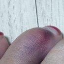 종로아산본정형외과의원 이미지