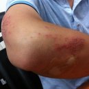 예스본한의원 이미지