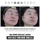 나성동_명동프라자옆BRT 이미지