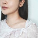 중앙로 권혁칠피부과 앞 | 대구 동성로 피부과 하이톡스 승모근 종아리 보톡스 통증 후기