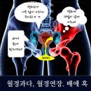 동김해메디컬센터 | 자궁근종 걱정만 하지 말고 자궁근종한의원 경희기린한의원에서 치료 받고 건강 찾자.