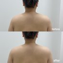 궁골프존 | 천안 불당동 은율에스테틱, 테라노바 근막·윤곽관리만했는데 라운드숄더까지 관리됐어요