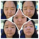 대산의료기 네이버블로그