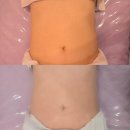 아름다울 스킨앤바디 | 김해 삼정동 바디관리 피부관리 수기관리 웨딩관리 쥬리스킨앤바디 후기(+주차정보)