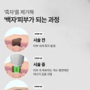 비앤미