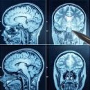 CT MRI 차이 저선량폐CT 뇌 허리 복부 경추 흉부 요추 간 촬영 이미지