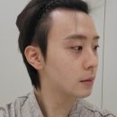눈밑지방재배치, 눈밑 지방이식 수술 및 경과 후기(수술당일~5일차)/회복 과정/부작용/멍,붓기,통증