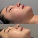 도예기능 | 연산동 피부관리 도예스킨 부산 플라즈마, 써마지, 하이푸 리프팅부터 피부진정재생관리까지 내돈내산 후기