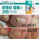 네일 플러스 이미지