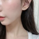 선피부과의원 | [시청역피부과] 광화문피부과 ㅆㅁ의원 온다리프팅 솔직 후기 | 효과/ 2주차 경과 전후 비교