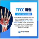 마디웰정형외과의원 | 고잔동정형외과 시큰거리는 손목질환, 삼각섬유연골복합체파열 주목