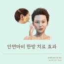 온세한의원 | 안면마비 한의원 치료 효과적인 이유 [부산 남천동 온세한의원 건강정보]