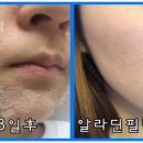 알라딘필링 이미지