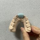 하이교정치과기공소 이미지