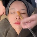 바로상화제일차 | 나는솔로 30기 옥순 픽 고우리 스킨부스터 후기 효과, 통증, 가격, 후관리