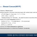 유방암1A 진단 후 재발되어 3기 상황에서 치료된 사례 이미지
