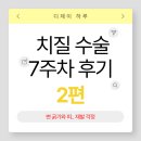 변*남 | 치질 수술 7주차 후기 2편 | 변 굵기와 피 재발 걱정