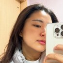 해주사우나 | 방배피부관리 미가연 에스테틱 써마지 더블 리프팅 후기