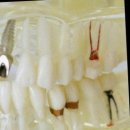 더이룸치과의원 | 😨치과만 가면 덜덜… 치과 공포증 극복하는 현실적인 방법 5가지🦷✨