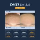 서윤피부맑음 명동점