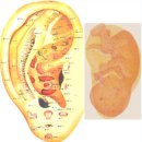 귀건강(이혈테라피) 이미지