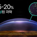 아이준안과 이미지