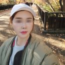 빌리프성형외과의원 | 빌리프성형외과 안면거상후기 (회복과정 제대로 보여드림)