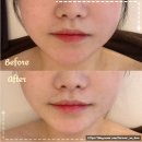 1회만으로 얼굴붓기 빠지던 신중동윤곽관리 보테에스테틱 솔직후기, 주차